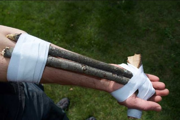 Make Shift Splint
